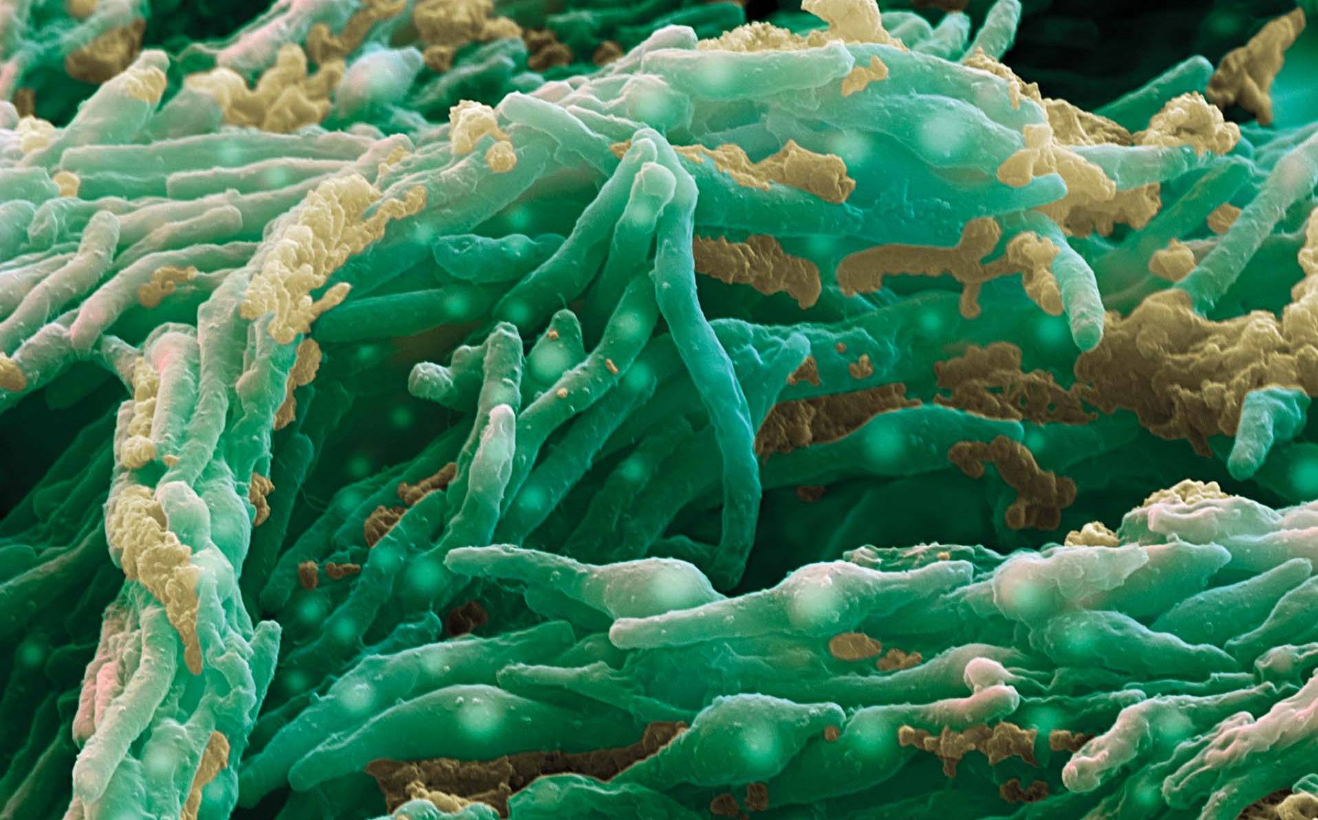 microscopie d'une bactérie mycobacterium bovis