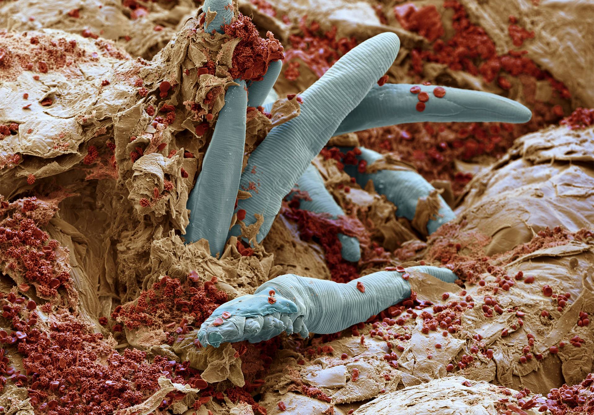 acarien en microscopie