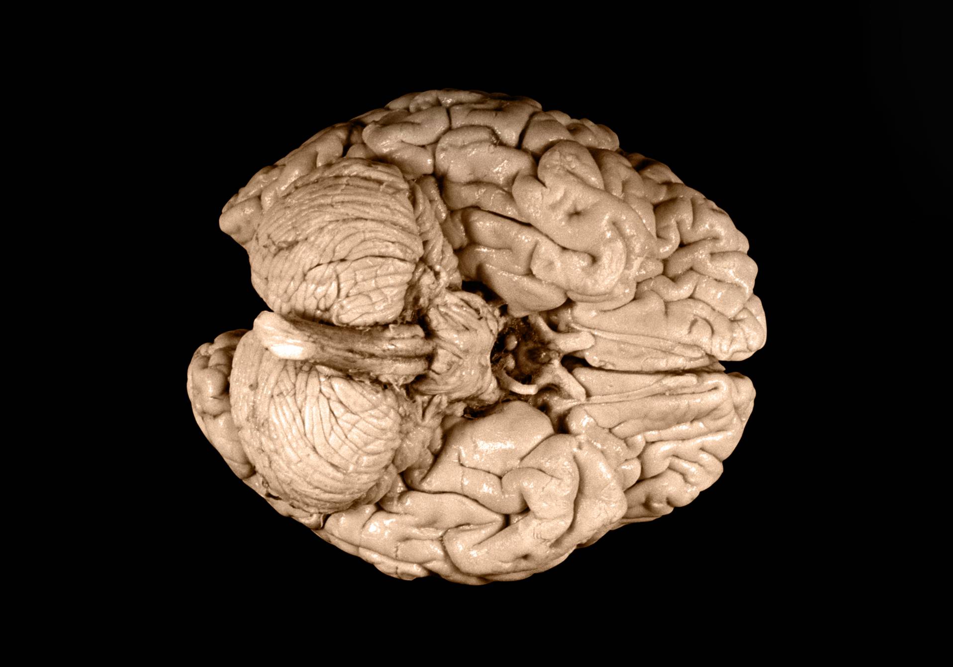Photographie du cerveau d’Einstein